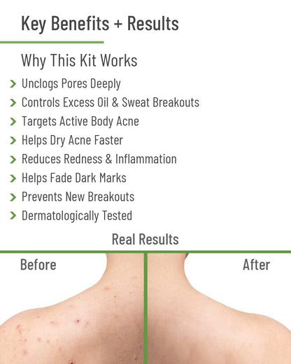Clinical Body Acne Treatment Kit
